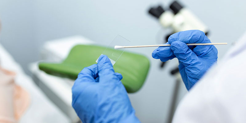 Test Pap – Thin Prep – HPV DNA Test